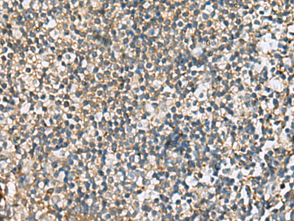 Immunohistochemistry of paraffin-embedded Human tonsil tissue  using CXCR5 Polyclonal Antibody at dilution of 1:60(×200)