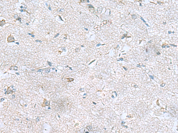 Immunohistochemistry of paraffin-embedded Human brain tissue  using GFRA1 Polyclonal Antibody at dilution of 1:65(×200)