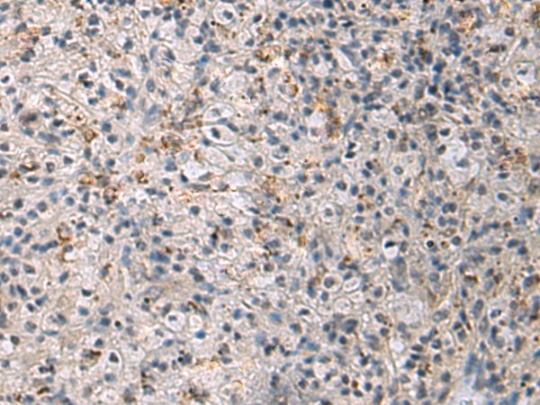 Immunohistochemistry of paraffin-embedded Human brain tissue  using IRS4 Polyclonal Antibody at dilution of 1:45(×200)