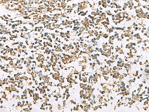 Immunohistochemistry of paraffin-embedded Human tonsil tissue  using SLC16A1 Polyclonal Antibody at dilution of 1:30(×200)