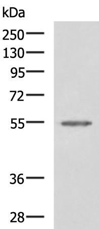Western blot analysis of Jurkat cell lysate  using SLC16A1 Polyclonal Antibody at dilution of 1:550