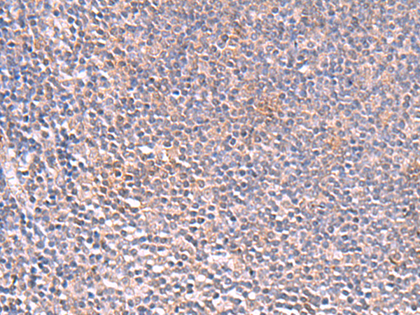 Immunohistochemistry of paraffin-embedded Human tonsil tissue  using SLC16A7 Polyclonal Antibody at dilution of 1:35(×200)