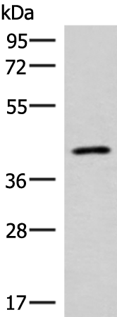 Western blot analysis of Human abdominal interstitial sarcoma tissue lysate  using SLC16A7 Polyclonal Antibody at dilution of 1:400