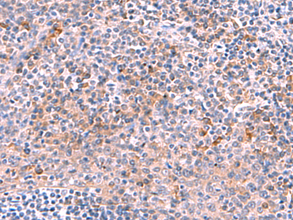 Immunohistochemistry of paraffin-embedded Human tonsil tissue  using NCAN Polyclonal Antibody at dilution of 1:30(×200)