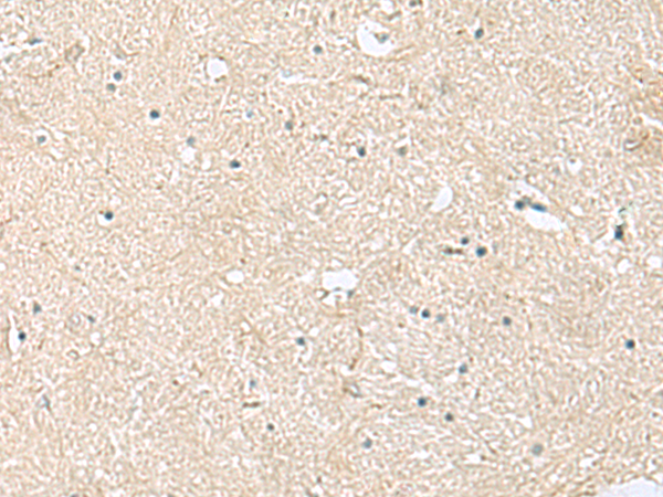Immunohistochemistry of paraffin-embedded Human brain tissue  using VEGFA Polyclonal Antibody at dilution of 1:60(×200)