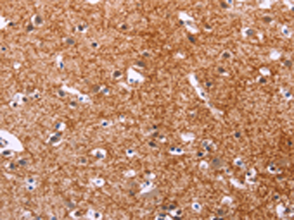 Immunohistochemistry of paraffin-embedded Human brain tissue  using APMAP Polyclonal Antibody at dilution of 1:30(×200)