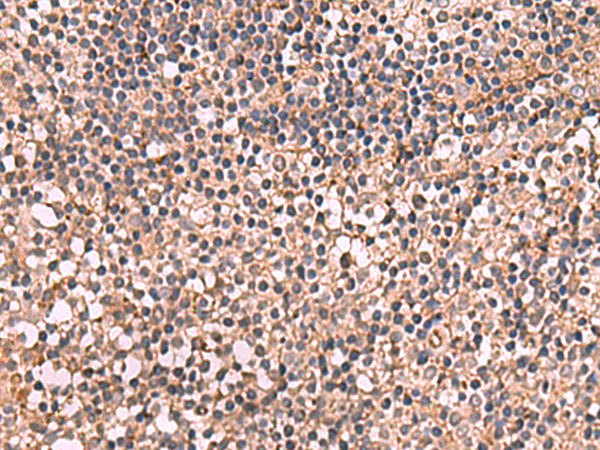 Immunohistochemistry of paraffin-embedded Human tonsil tissue  using NOTCH4 Polyclonal Antibody at dilution of 1:30(×200)