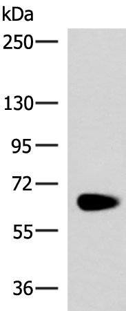 Western blot analysis of Human left kidney paracancerous tissue lysate  using NOTCH4 Polyclonal Antibody at dilution of 1:800