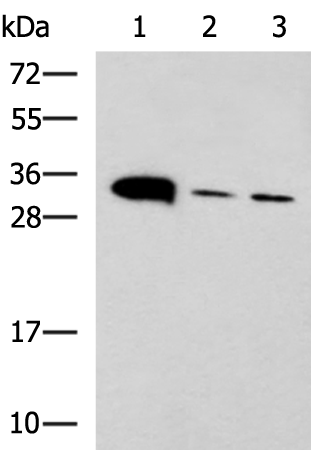 Western blot analysis of Mouse heart tissue Mouse stomach tissue and PC-3 cell lysates  using PSCA Polyclonal Antibody at dilution of 1:650