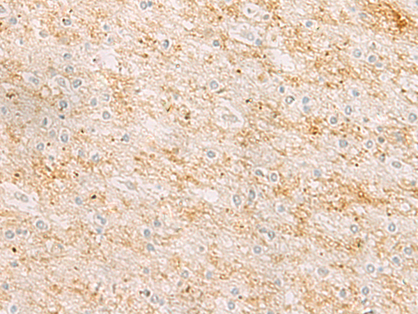 Immunohistochemistry of paraffin-embedded Human brain tissue  using RHCG Polyclonal Antibody at dilution of 1:25(×200)