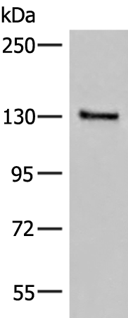 Western blot analysis of Human urinary bladder tissue lysate  using SASH1 Polyclonal Antibody at dilution of 1:300