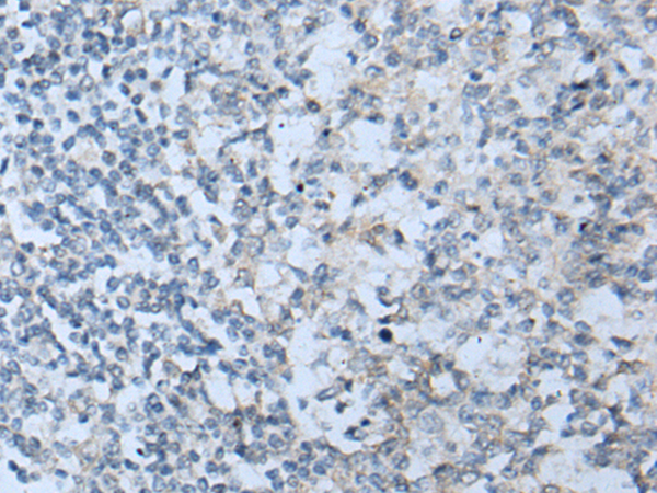 Immunohistochemistry of paraffin-embedded Human tonsil tissue  using STARD4 Polyclonal Antibody at dilution of 1:50(×200)