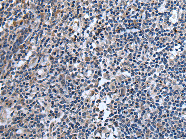 Immunohistochemistry of paraffin-embedded Human tonsil tissue  using TNFSF18 Polyclonal Antibody at dilution of 1:45(×200)