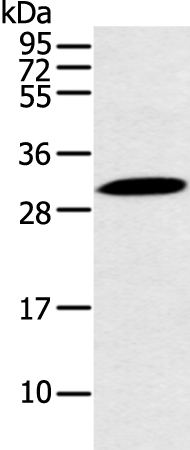 Western blot analysis of Mouse stomach tissue  using YRDC Polyclonal Antibody at dilution of 1:250