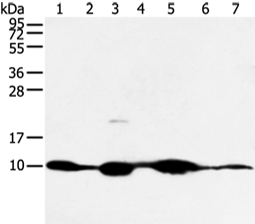 Western blot analysis of Mouse muscle and human fetal muscle tissue mouse heart tissue and PC3 cell mouse kidney and small intestines tissue 231 cell  using COX7C Polyclonal Antibody at dilution of 1:300