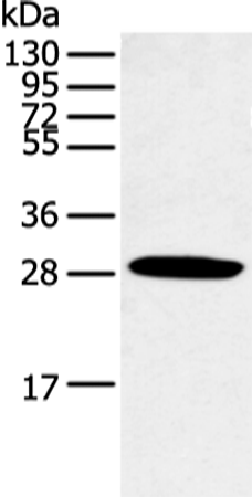 Western blot analysis of Human normal lung tissue  using CLDN25 Polyclonal Antibody at dilution of 1:250