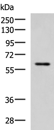Western blot analysis of MCF7 cell lysate  using ECM1 Polyclonal Antibody at dilution of 1:1000
