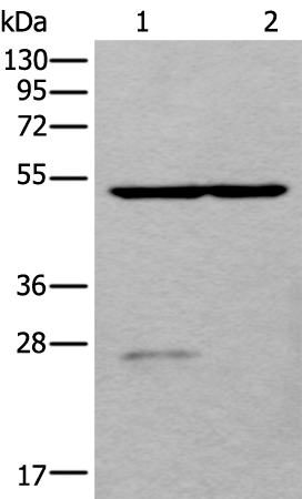 Western blot analysis of Human left kidney tissue and Human fetal liver tissue lysates  using DDC Polyclonal Antibody at dilution of 1:800