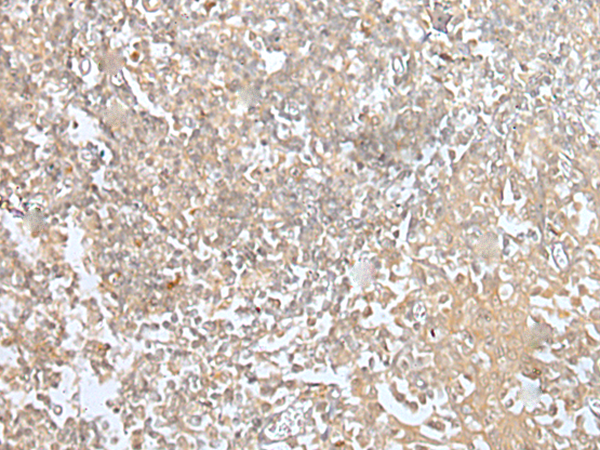 Immunohistochemistry of paraffin-embedded Human tonsil tissue  using MORF4L1 Polyclonal Antibody at dilution of 1:45(×200)