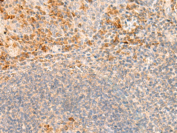 Immunohistochemistry of paraffin-embedded Human tonsil tissue  using GRM2 Polyclonal Antibody at dilution of 1:35(×200)