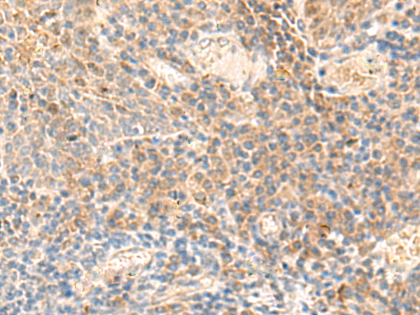 Immunohistochemistry of paraffin-embedded Human tonsil tissue  using ABHD2 Polyclonal Antibody at dilution of 1:50(×200)