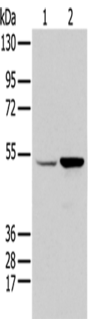 Western blot analysis of HEPG2 and 231 cell  using EGR2 Polyclonal Antibody at dilution of 1:350
