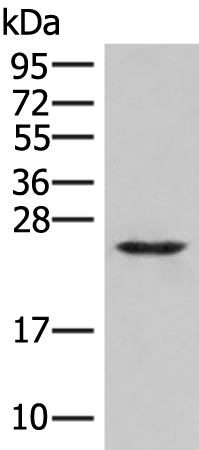 Western blot analysis of Human fetal brain tissue lysate  using MRAS Polyclonal Antibody at dilution of 1:400