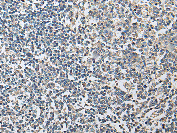 Immunohistochemistry of paraffin-embedded Human tonsil tissue  using PLA2G16 Polyclonal Antibody at dilution of 1:40(×200)