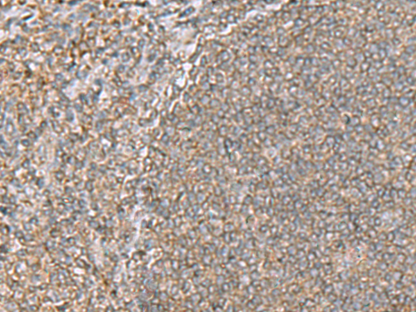 Immunohistochemistry of paraffin-embedded Human tonsil tissue  using ARF5 Polyclonal Antibody at dilution of 1:55(×200)