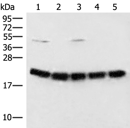 Western blot analysis of Raji cell Mouse brain tissue Hela A375 and 231 cell lysates  using ARF5 Polyclonal Antibody at dilution of 1:400