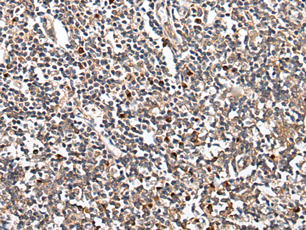 Immunohistochemistry of paraffin-embedded Human tonsil tissue  using HOXB9 Polyclonal Antibody at dilution of 1:45(×200)