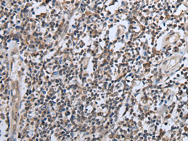 Immunohistochemistry of paraffin-embedded Human tonsil tissue  using CXCL6 Polyclonal Antibody at dilution of 1:60(×200)