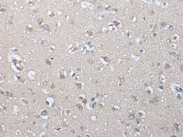 Immunohistochemistry of paraffin-embedded Human brain tissue  using IFNB1 Polyclonal Antibody at dilution of 1:45(×200)