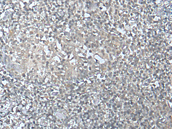 Immunohistochemistry of paraffin-embedded Human tonsil tissue  using MEF2D Polyclonal Antibody at dilution of 1:50(×200)