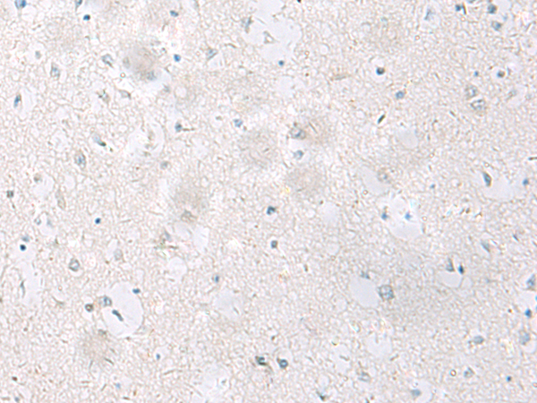 Immunohistochemistry of paraffin-embedded Human brain tissue  using SST Polyclonal Antibody at dilution of 1:60(×200)