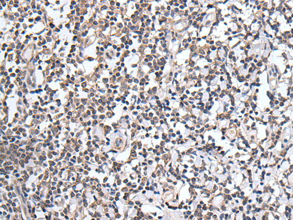 Immunohistochemistry of paraffin-embedded Human tonsil tissue  using PLAG1 Polyclonal Antibody at dilution of 1:25(×200)