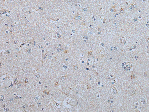 Immunohistochemistry of paraffin-embedded Human brain tissue  using CENPF Polyclonal Antibody at dilution of 1:60(×200)