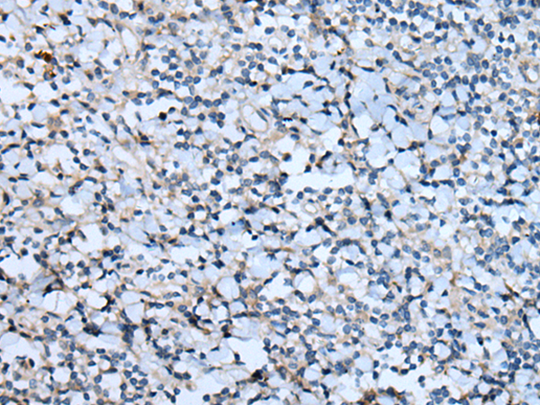 Immunohistochemistry of paraffin-embedded Human tonsil tissue  using CNTN1 Polyclonal Antibody at dilution of 1:55(×200)