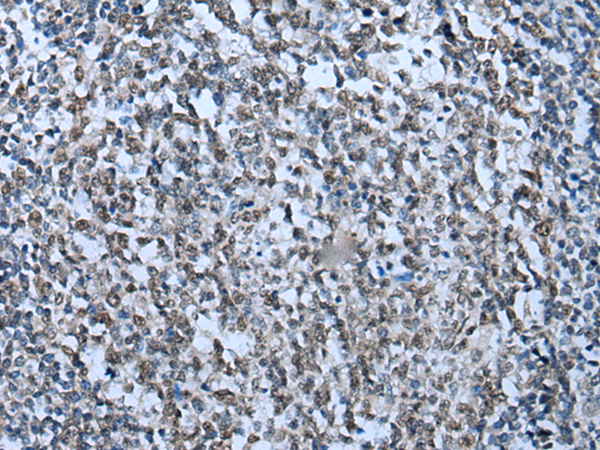 Immunohistochemistry of paraffin-embedded Human tonsil tissue  using ZNHIT3 Polyclonal Antibody at dilution of 1:95(×200)