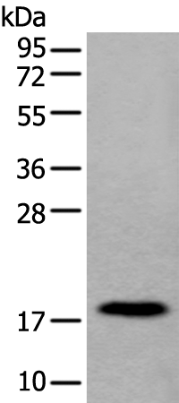 Western blot analysis of Human urinary bladder tissue lysate  using MYL12B Polyclonal Antibody at dilution of 1:250