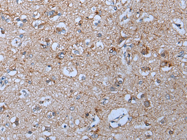 Immunohistochemistry of paraffin-embedded Human brain tissue  using YPEL5 Polyclonal Antibody at dilution of 1:60(×200)