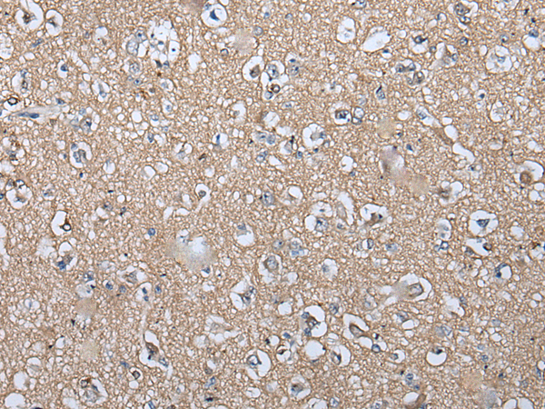 Immunohistochemistry of paraffin-embedded Human brain tissue  using WIF1 Polyclonal Antibody at dilution of 1:100(×200)