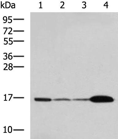 Western blot analysis of Mouse brain tissue Hela cell LNCAP cell HepG2 cell Jurkat cell lysates  using UBE2N Polyclonal Antibody at dilution of 1:800
