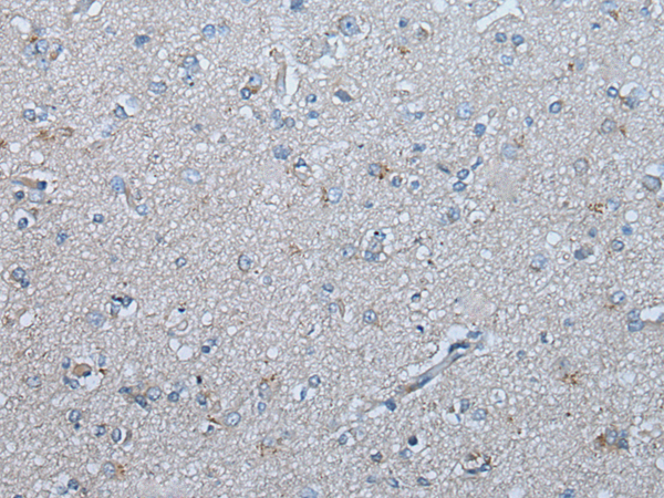 Immunohistochemistry of paraffin-embedded Human brain tissue  using UBR4 Polyclonal Antibody at dilution of 1:65(×200)