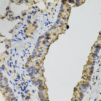 Immunohistochemistry of paraffin-embedded Mouse lung using DNM2 Polyclonal Antibody