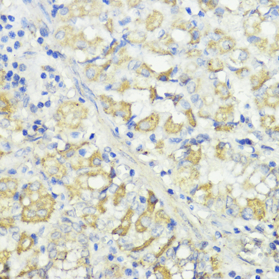 Immunohistochemistry of paraffin-embedded Human stomach using CTSB Polyclonal Antibody at dilution of  1:100 (40x lens).