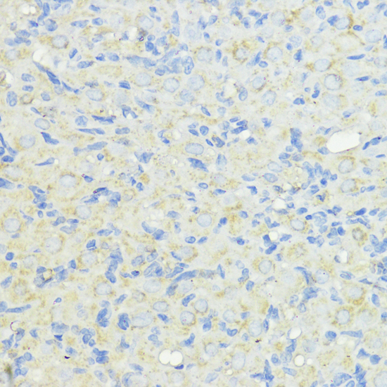 Immunohistochemistry of paraffin-embedded Rat ovary using CTSB Polyclonal Antibody at dilution of  1:100 (40x lens).