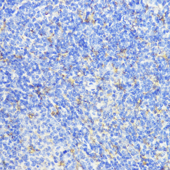 Immunohistochemistry of paraffin-embedded Mouse spleen using CTSB Polyclonal Antibody at dilution of  1:100 (40x lens).