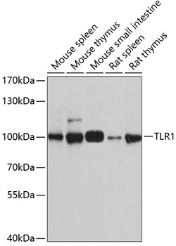 Western blot analysis of extracts of various cell lines using TLR1 Polyclonal Antibody at dilution of 1:1000.