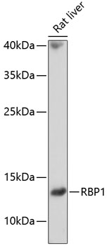 Western blot analysis of extracts of Rat liver using RBP1 Polyclonal Antibody at dilution of 1:1000.